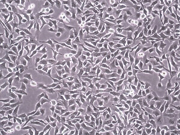 sBT-RMS Spontaneous Brain-tropic RET Melanoma-sorted Mouse Cell Line ...